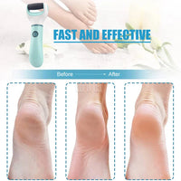 Electric Foot Grinder Dead Skin Remover Feet Scrubber Callus Shaver Remove Dry Dead Cracked Safe Foot Care Tool Outdoor Kinetics