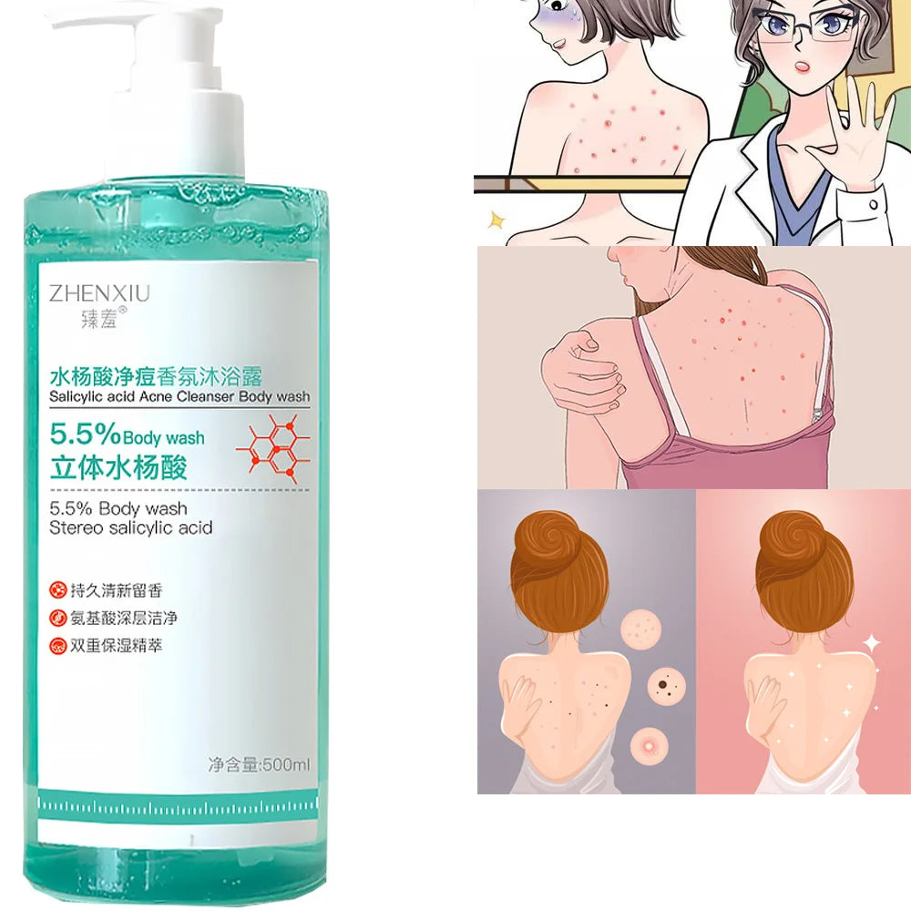 16.9 oz Salicylic Acid Body Wash, Gentle & Smoothing  Mild Exfoliating Daily Acne Body Wash Deep Cleanses Back Acne and Sebum Outdoor Kinetics