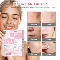 5 in 1 Moisturizing Facial Cleanser Refreshed Cleansing Makeup Remover Brightening Hydrating Light Texture Rich Foam Cleanser Outdoor Kinetics